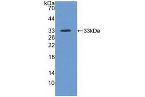 Detection of Recombinant ITIH4, Human using Polyclonal Antibody to Inter Alpha-Globulin Inhibitor H4 (ITIH4) (ITIH4 antibody  (AA 683-928))
