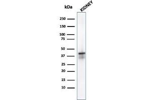 Western Blot analysis of Kidney tissue lysate using AMACR Mouse Monoclonal Antibody (AMACR/1723). (AMACR antibody)