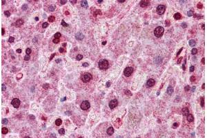 Human Liver: Formalin-Fixed, Paraffin-Embedded (FFPE) (HNF4A antibody  (C-Term))