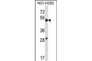 DUSP9 Antibody (C-term) (ABIN657812 and ABIN2846780) western blot analysis in NCI- cell line lysates (35 μg/lane). (DUSP9 antibody  (C-Term))