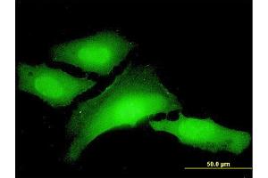 Immunofluorescence of monoclonal antibody to PCBP1 on HeLa cell.