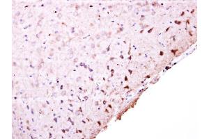 IHC-P Image PFKFB4 antibody [N3C3] detects PFKFB4 protein at cytosol on mouse middle brain by immunohistochemical analysis. (PFKFB4 antibody)