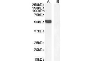 GATA1 antibody  (Internal Region)