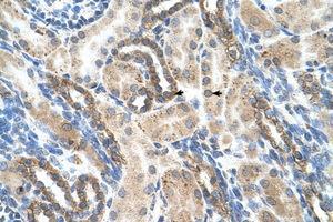 Image no. 2 for anti-Pregnancy Specific beta-1-Glycoprotein 1 (PSG1) (AA 96-145) antibody (ABIN204992)