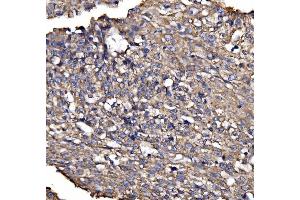 IHC analysis of BRSK1 using anti-BRSK1 antibody (ABIN7600990). (BRSK1 antibody  (AA 269-321))