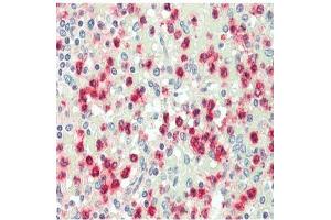 Immunohistochemistry analysis of Cathepsin G Antibody in paraffin-embedded human spleen tissue at 1/100. (Cathepsin G antibody)