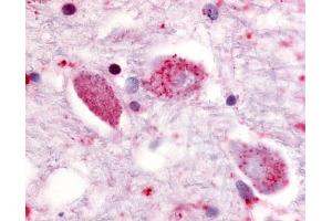 Anti-GPR85 antibody IHC of human putamen, neurons. (GPR85 antibody  (Cytoplasmic Domain))