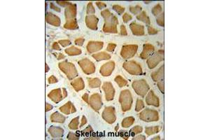 DHRS7 Antibody immunohistochemistry analysis in formalin fixed and paraffin embedded human skeletal muscle followed by peroxidase conjugation of the secondary antibody and DAB staining. (DHRS7 antibody  (N-Term))