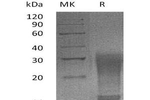Western Blotting (WB) image for Interleukin 13 (IL13) (AA 26-131) (Active) protein (His tag) (ABIN7320576) (IL-13 Protein (AA 26-131) (His tag))