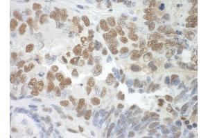 Immunohistochemistry (IHC) image for anti-Splicing Factor 3a, Subunit 3, 60kDa (SF3A3) (AA 451-501) antibody (ABIN7448790)