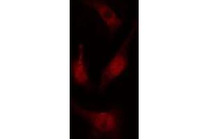 ABIN6274699 staining COLO205 cells by IF/ICC.