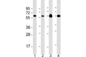 Western blot testing of 1) Daudi, 2) HL-60 cell lysate, 3) human brain and 4) mouse brain lysate with PACSIN2 antibody at 1:2000. (PACSIN2 antibody  (AA 250-486))