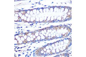 Immunohistochemistry (IHC) image for anti-Fibroblast Growth Factor 2 (Basic) (FGF2) antibody (ABIN7267184)