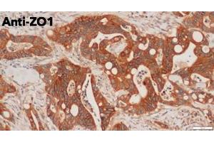 Immunohistochemistry (IHC) image for anti-Tight Junction Protein 1 (TJP1) (C-Term) antibody (ABIN6254231) (TJP1 antibody  (C-Term))