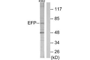 Western blot analysis of extracts from K562 cells, using ZNF147 antibody. (TRIM25 antibody  (Internal Region))