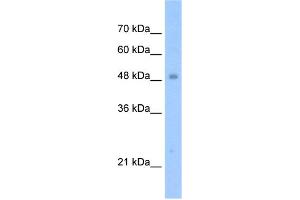 WB Suggested Anti-TIGD3 Antibody Titration:  1.