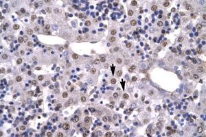 Image no. 3 for anti-High Mobility Group Box 2 (HMGB2) (C-Term) antibody (ABIN6735776) (HMGB2 antibody  (C-Term))