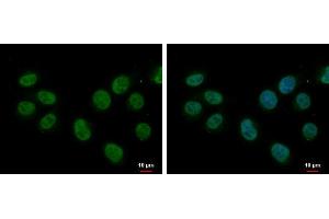 ICC/IF Image splicing factor 1 antibody [N1N3] detects splicing factor 1 protein at nucleus by immunofluorescent analysis. (Splicing Factor 1 antibody)