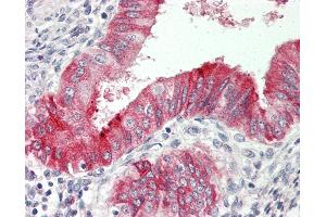 Human Uterus: Formalin-Fixed, Paraffin-Embedded (FFPE)