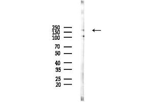 Western blot analysis of lysates from HepG2 cells(LPS,4h treatment), using LMO7 Antibody at 1/1000 dilution.