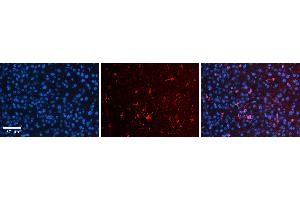 Rabbit Anti-OSBPL8 Antibody   Formalin Fixed Paraffin Embedded Tissue: Human Liver Tissue Observed Staining: Cytoplasm and plasma membrane in Kupffer cells and sinusoids Primary Antibody Concentration: 1:100 Other Working Concentrations: 1:600 Secondary Antibody: Donkey anti-Rabbit-Cy3 Secondary Antibody Concentration: 1:200 Magnification: 20X Exposure Time: 0. (OSBPL8 antibody  (N-Term))