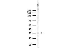 Western blot analysis of lysates from EC304 cells, using HS Antibody at 1/1000 dilution.