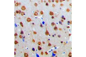 Immunohistochemical analysis of AKAP13 staining in human brain formalin fixed paraffin embedded tissue section. (AKAP13 antibody  (Center))