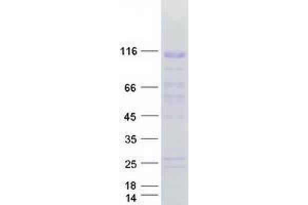 ZNF606 Protein (Myc-DYKDDDDK Tag)