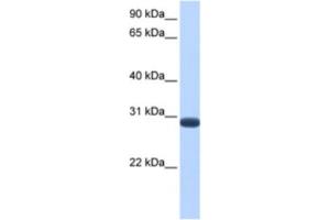 Western Blotting (WB) image for anti-Dual Specificity Phosphatase 19 (DUSP19) antibody (ABIN2463531)