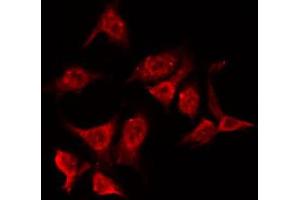 ABIN6266787 staining HeLa by IF/ICC. (NPM1 antibody  (N-Term))