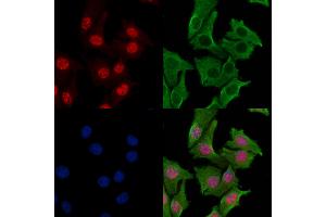 ABIN7093538 and ABIN7097562 staining Hela cells by IF/ICC.