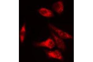 ABIN6275667 staining  COLO205 cells by IF/ICC. (UGDH antibody  (C-Term))