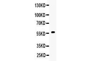 Western blot analysis of CYP17A1 expression in 22RV1 whole cell lysates ( Lane 1). (CYP17A1 antibody  (C-Term))