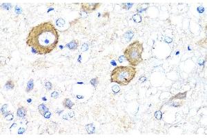 Immunohistochemistry of paraffin-embedded Rat brain using NRG4 Polyclonal Antibody at dilution of 1:100 (40x lens). (Neuregulin 4 antibody)