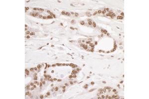 Immunohistochemistry (IHC) image for anti-Damage Specific DNA Binding Protein 1 (DDB1) (C-Term) antibody (ABIN7454634) (DDB1 antibody  (C-Term))