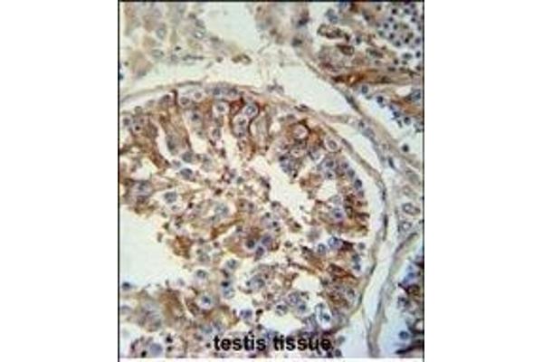 SPACA1 antibody  (N-Term)