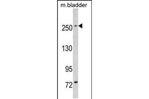 Western blot analysis of LRRK1 in mouse bladder tissue lysates (35ug/lane) (LRRK1 antibody  (C-Term))