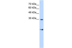 Western Blotting (WB) image for anti-Vacuolar-sorting Protein SNF8 (SNF8) antibody (ABIN2460244)