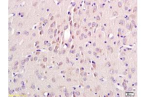 Formalin-fixed and paraffin embedded rat brain labeled with Rabbit Anti Annexin A13 Polyclonal Antibody, Unconjugated (ABIN735323) at 1:200 followed by conjugation to the secondary antibody and DAB staining (MSH alpha (AA 138-150) antibody)