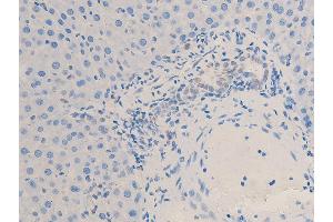 Immunohistochemistry (IHC) image for anti-Checkpoint Kinase 2 (CHEK2) (pThr68) antibody (ABIN6256592)