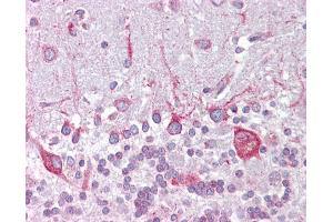 Anti-PSEN1 / Presenilin 1 antibody IHC of human brain, cerebellum. (Presenilin 1 antibody  (AA 107-156))