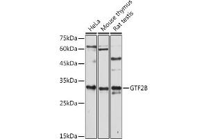 Western blot analysis of extracts of various cell lines, using GTF2B antibody (ABIN7267370) at 1:1000 dilution. (GTF2B antibody  (AA 50-150))