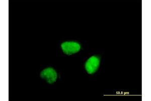 Immunofluorescence of purified MaxPab antibody to CCNA2 on HeLa cell.