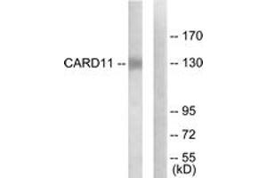 Western blot analysis of extracts from COLO205 cells, using CARD11 Antibody. (CARD11 antibody  (AA 10-59))