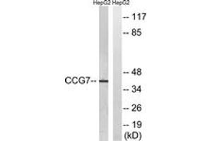Western blot analysis of extracts from HepG2 cells, using CACNG7 Antibody. (CACNG7 antibody  (AA 198-247))