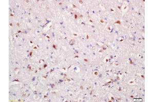 Formalin-fixed and paraffin embedded rat brain tissue labeled with Rabbit Anti-Hrk Polyclonal Antibody, Unconjugated (ABIN2559409) at 1:200 followed by conjugation to the secondary antibody and DAB staining (HRK antibody  (AA 1-50))