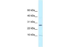 Western Blot showing RPL39 antibody used at a concentration of 1 ug/ml against Fetal Brain Lysate (RPL39 antibody  (N-Term))