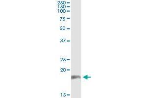 Immunoprecipitation of PPP2R3B transfected lysate using anti-PPP2R3B monoclonal antibody and Protein A Magnetic Bead , and immunoblotted with PPP2R3B MaxPab rabbit polyclonal antibody. (PPP2R3B antibody  (AA 1-225))