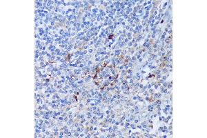 Immunohistochemistry of paraffin-embedded Human tonsil using P antibody (ABIN7269207) at dilution of 1:100 (40x lens). (PAD4 antibody  (AA 374-550))