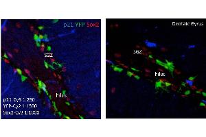 Immunohistochemistry of Mouse anti-p21 antibody. (p21 antibody)